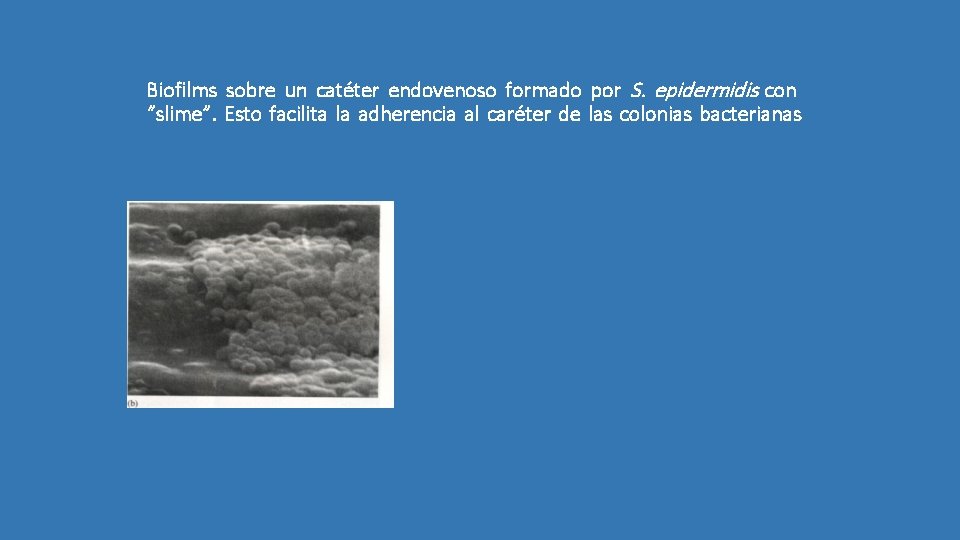 Biofilms sobre un catéter endovenoso formado por S. epidermidis con “slime”. Esto facilita la