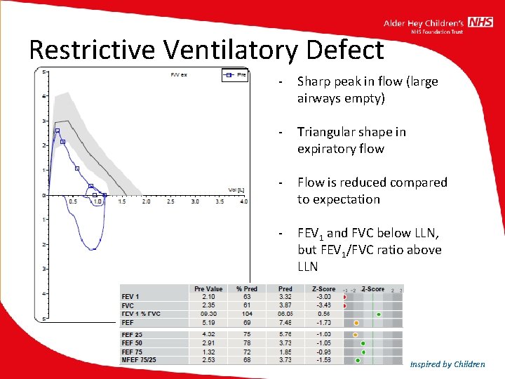 Restrictive Ventilatory Defect - Sharp peak in flow (large airways empty) - Triangular shape Restrictive Ventilatory Defect - Sharp peak in flow (large airways empty) - Triangular shape