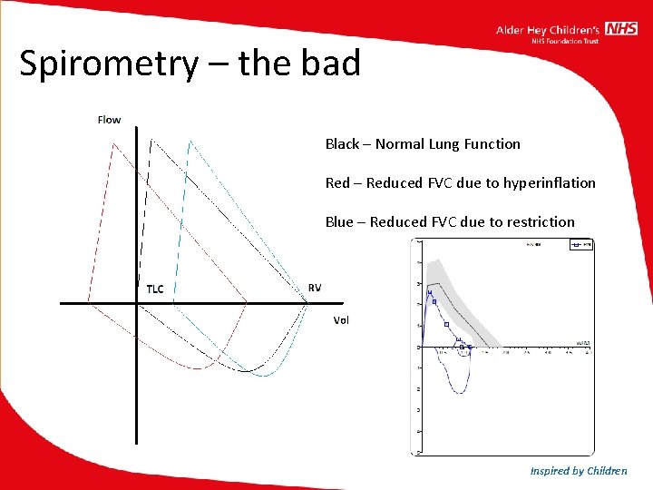 Spirometry – the bad Black – Normal Lung Function Red – Reduced FVC due Spirometry – the bad Black – Normal Lung Function Red – Reduced FVC due