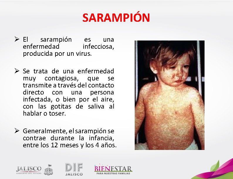 SARAMPIÓN Ø El sarampión es una enfermedad infecciosa, producida por un virus. Ø Se