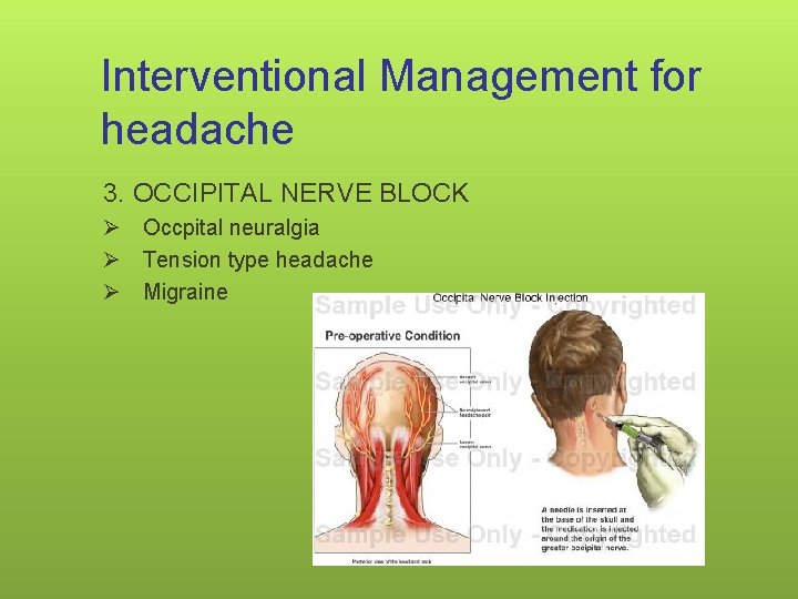 Interventional Management for headache 3. OCCIPITAL NERVE BLOCK Ø Occpital neuralgia Ø Tension type