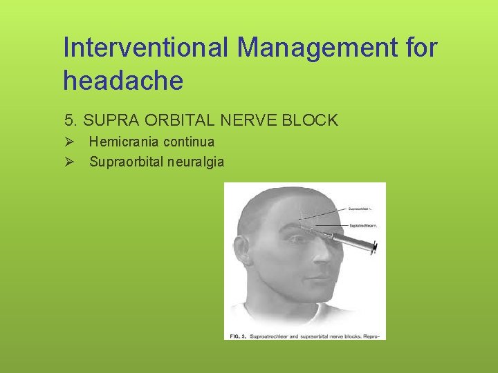 Interventional Management for headache 5. SUPRA ORBITAL NERVE BLOCK Ø Hemicrania continua Ø Supraorbital