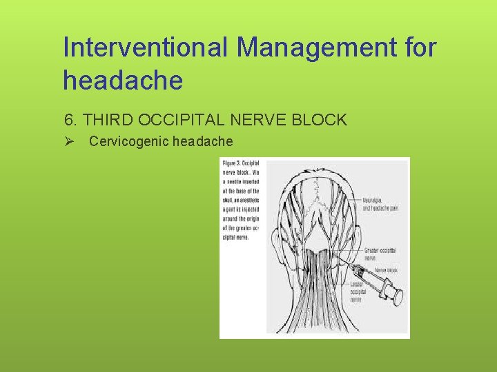 Interventional Management for headache 6. THIRD OCCIPITAL NERVE BLOCK Ø Cervicogenic headache 128 