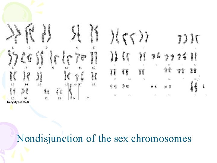 Nondisjunction of the sex chromosomes 