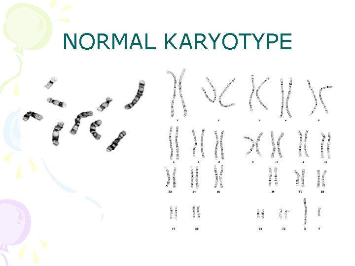 NORMAL KARYOTYPE 