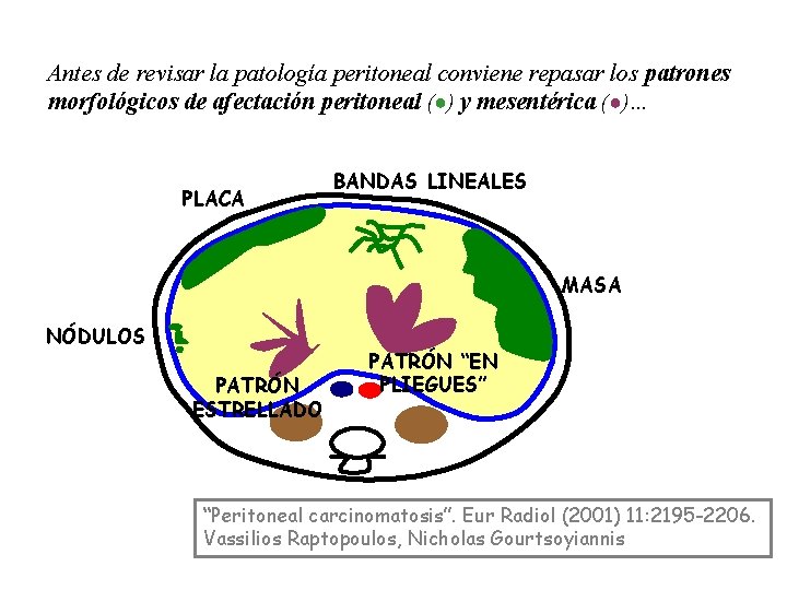 Antes de revisar la patología peritoneal conviene repasar los patrones morfológicos de afectación peritoneal Antes de revisar la patología peritoneal conviene repasar los patrones morfológicos de afectación peritoneal