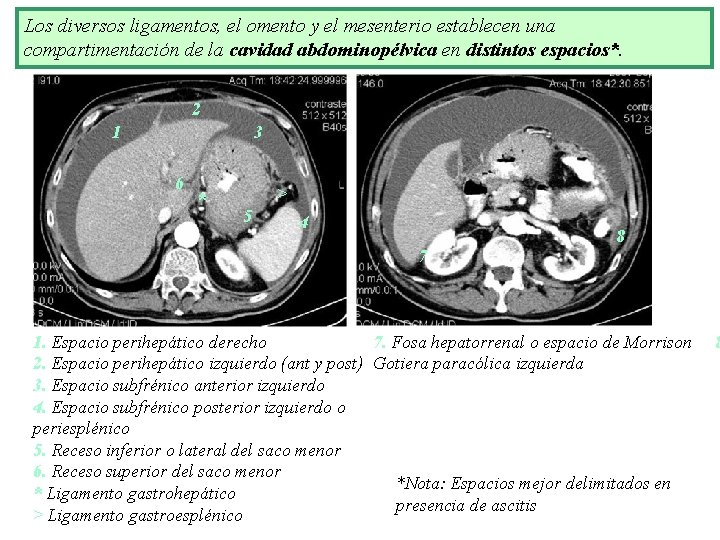 Los diversos ligamentos, el omento y el mesenterio establecen una compartimentación de la cavidad Los diversos ligamentos, el omento y el mesenterio establecen una compartimentación de la cavidad