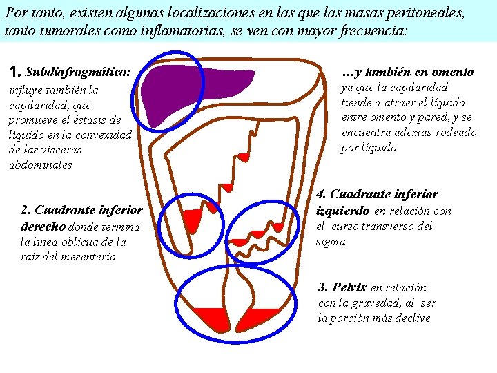 Por tanto, existen algunas localizaciones en las que las masas peritoneales, tanto tumorales como Por tanto, existen algunas localizaciones en las que las masas peritoneales, tanto tumorales como