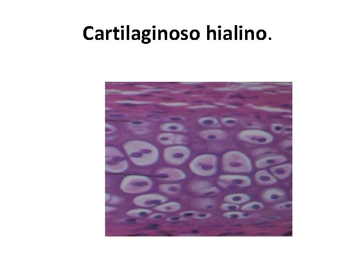 Cartilaginoso hialino 