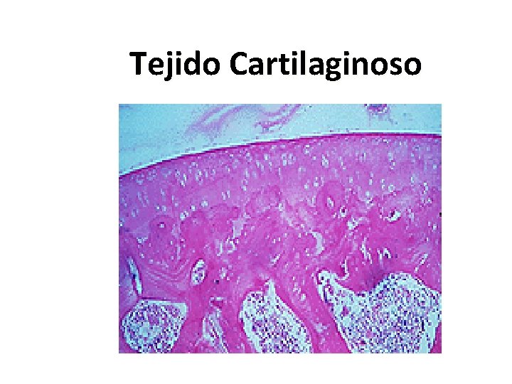 Tejido Cartilaginoso 