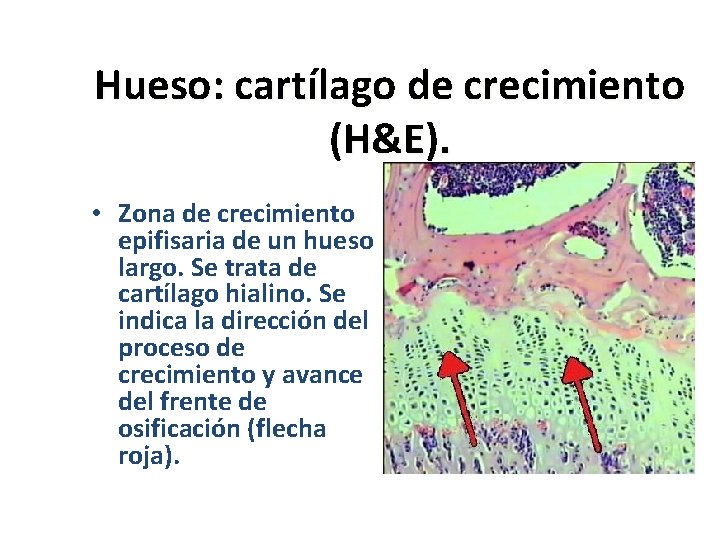 Hueso: cartílago de crecimiento (H&E). • Zona de crecimiento epifisaria de un hueso largo.