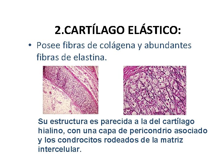 2. CARTÍLAGO ELÁSTICO: • Posee fibras de colágena y abundantes fibras de elastina. Su