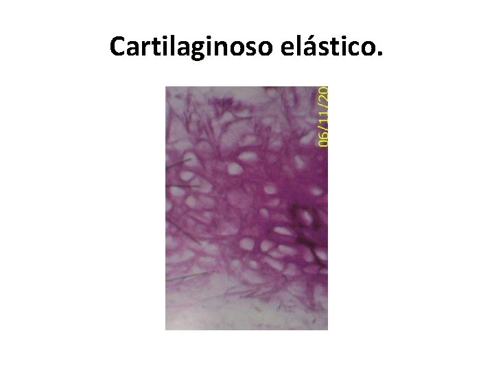 Cartilaginoso elástico. 