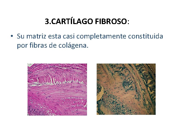 3. CARTÍLAGO FIBROSO: • Su matriz esta casi completamente constituida por fibras de colágena.