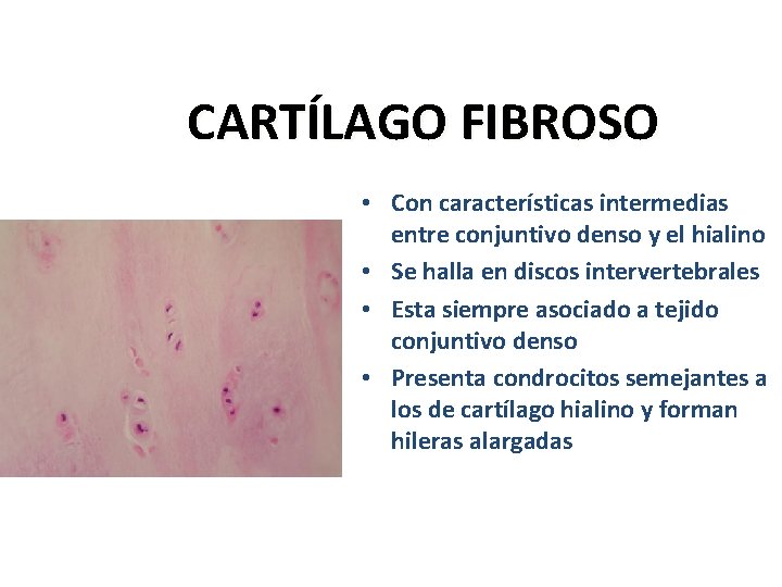 CARTÍLAGO FIBROSO • Con características intermedias entre conjuntivo denso y el hialino • Se