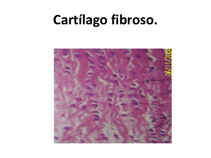 Cartílago fibroso. 