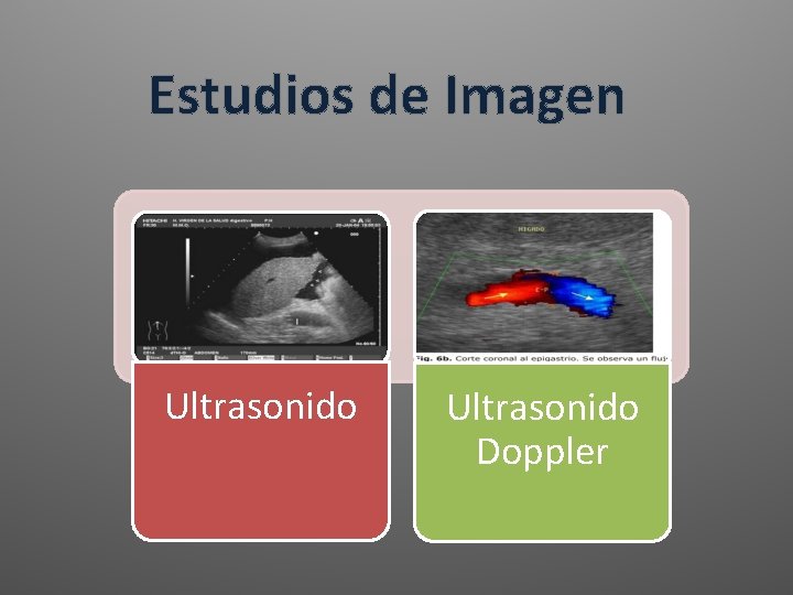 Estudios de Imagen Ultrasonido Doppler Estudios de Imagen Ultrasonido Doppler