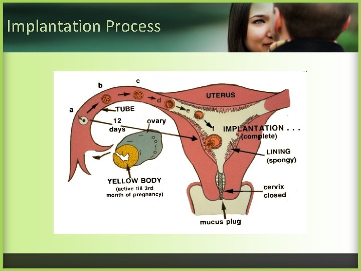 Implantation Process 