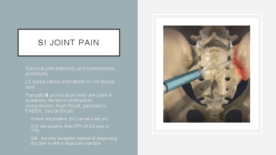 SI JOINT PAIN • Synovial joint anteriorly and syndesmosis posteriorly. • L 5 dorsal