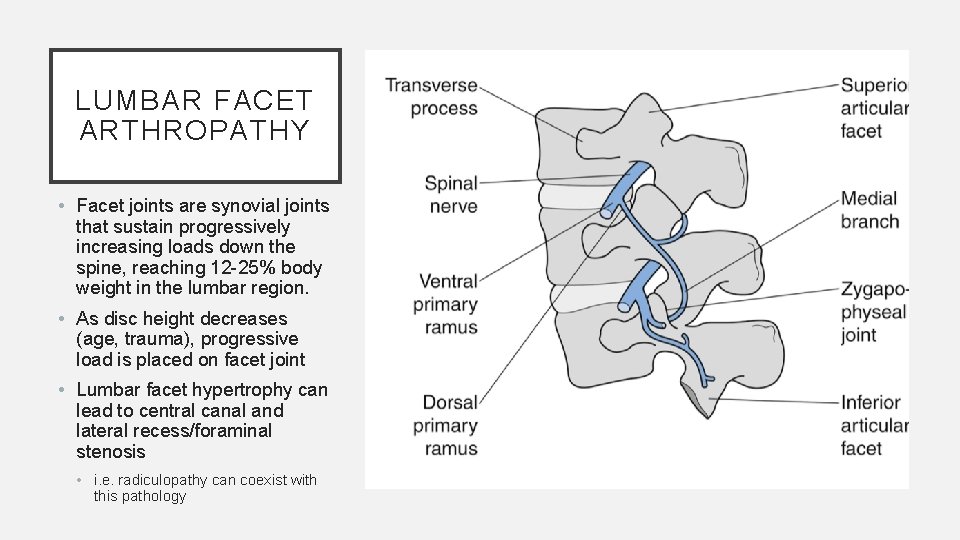 LUMBAR FACET ARTHROPATHY • Facet joints are synovial joints that sustain progressively increasing loads