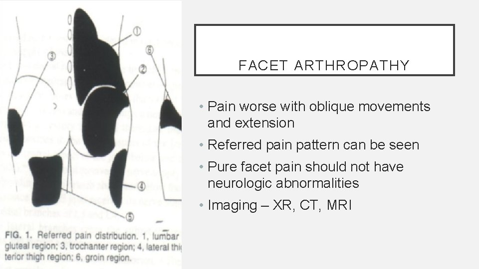 FACET ARTHROPATHY • Pain worse with oblique movements and extension • Referred pain pattern