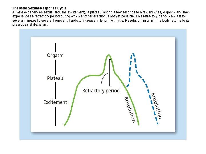 The Male Sexual-Response Cycle A male experiences sexual arousal (excitement), a plateau lasting a