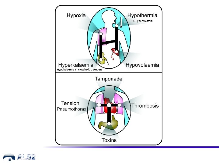 & Hyperthermia Hypokalaemia & metabolic disorders 