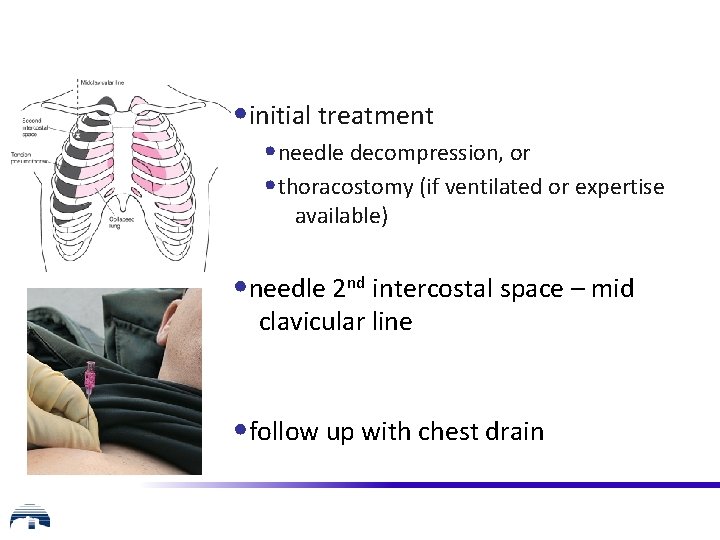  • initial treatment • needle decompression, or • thoracostomy (if ventilated or expertise
