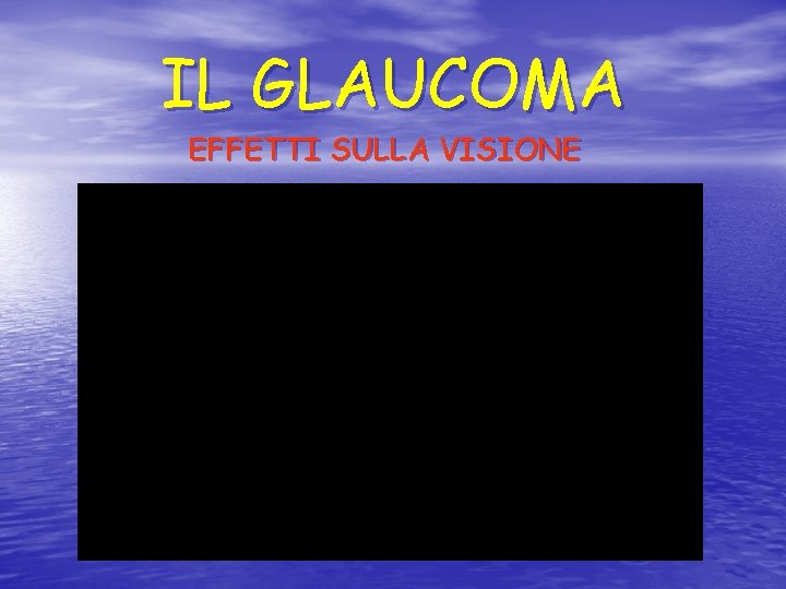 IL GLAUCOMA EFFETTI SULLA VISIONE 