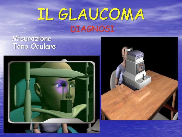 IL GLAUCOMA Misurazione Tono Oculare DIAGNOSI 