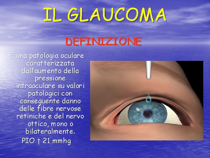 IL GLAUCOMA DEFINIZIONE E’ una patologia oculare caratterizzata dall’aumento della pressione intraoculare su valori