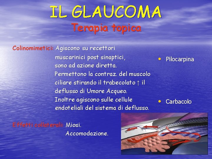 IL GLAUCOMA Terapia topica Colinomimetici: Agiscono su recettori muscarinici post sinaptici, sono ad azione
