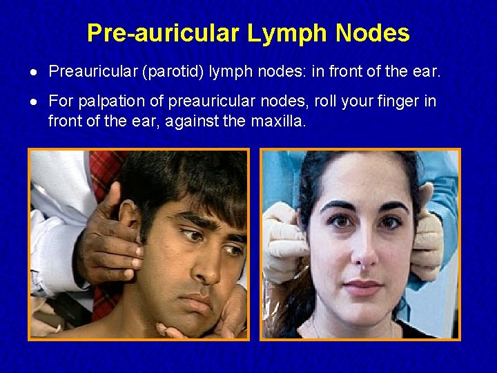 Pre-auricular Lymph Nodes · Preauricular (parotid) lymph nodes: in front of the ear. ·