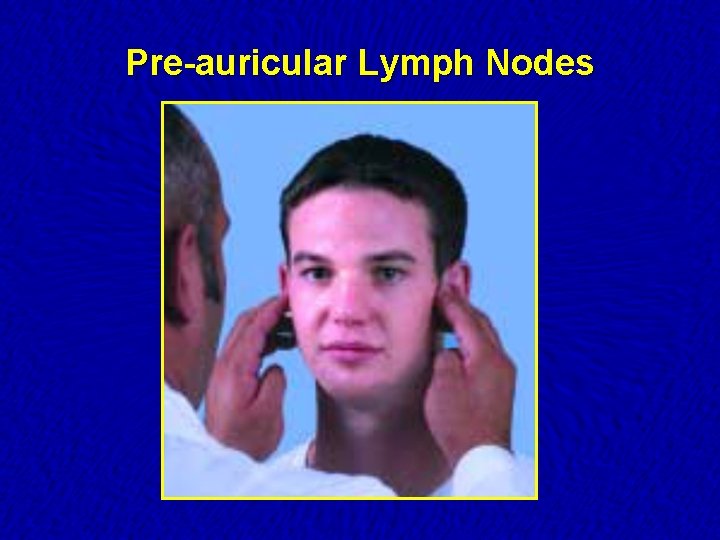 Pre-auricular Lymph Nodes 