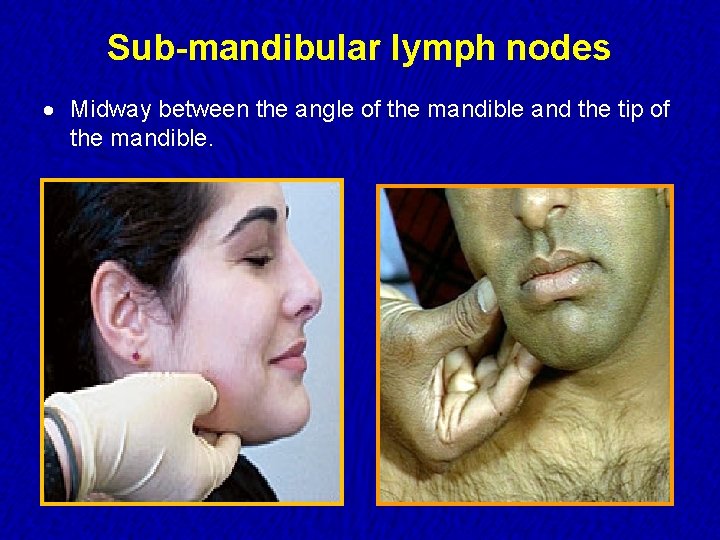 Sub-mandibular lymph nodes · Midway between the angle of the mandible and the tip