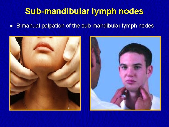 Sub-mandibular lymph nodes · Bimanual palpation of the sub-mandibular lymph nodes 