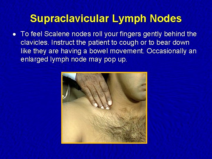 Supraclavicular Lymph Nodes · To feel Scalene nodes roll your fingers gently behind the