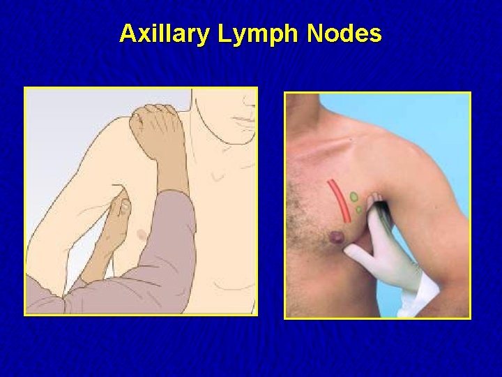 where are lymph nodes