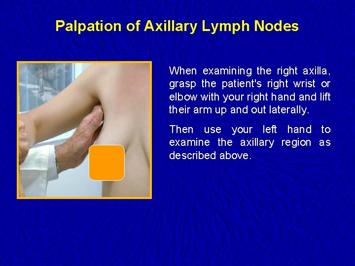 Palpation of Axillary Lymph Nodes When examining the right axilla, grasp the patient's right