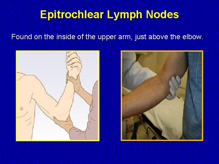 Epitrochlear Lymph Nodes Found on the inside of the upper arm, just above the