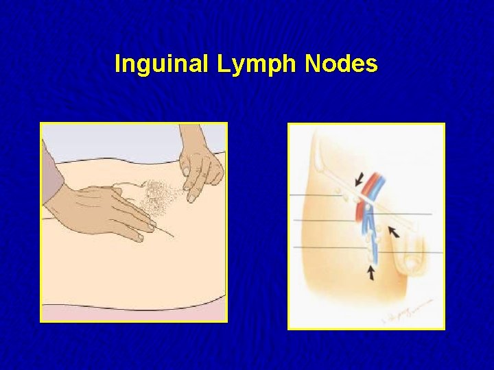 Inguinal Lymph Nodes 