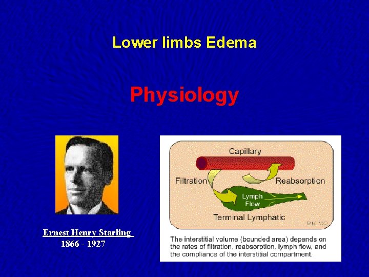 Lower limbs Edema Physiology Ernest Henry Starling 1866 - 1927 