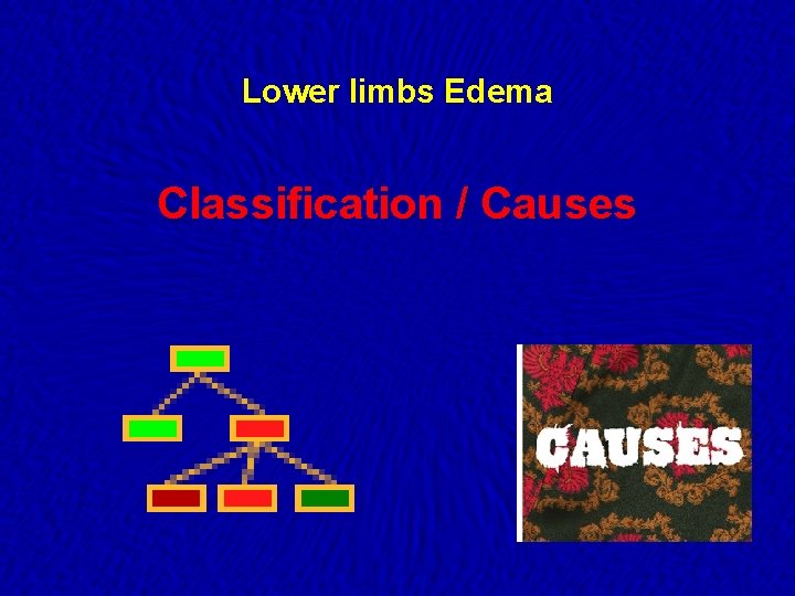 Lower limbs Edema Classification / Causes 