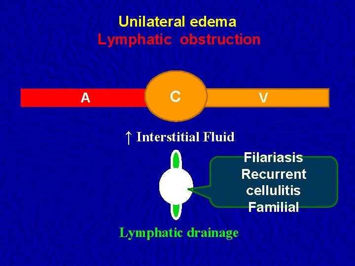 Unilateral edema Lymphatic obstruction A C V ↑ Interstitial Fluid Filariasis Recurrent cellulitis Familial