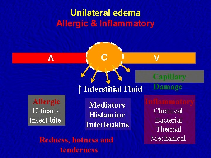 Unilateral edema Allergic & Inflammatory A C ↑ Interstitial Fluid Allergic Urticaria Insect bite