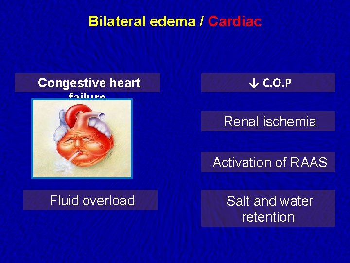 Bilateral edema / Cardiac Congestive heart failure ↓ C. O. P Renal ischemia Activation