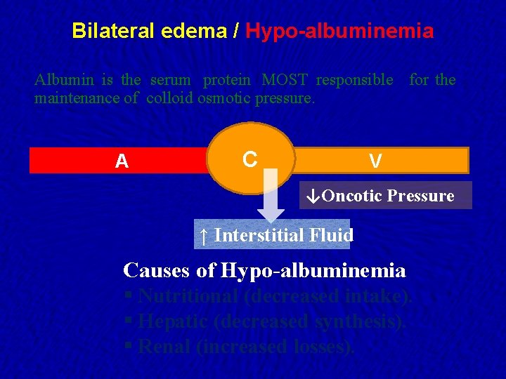 Bilateral edema / Hypo-albuminemia Albumin is the serum protein MOST responsible for the maintenance