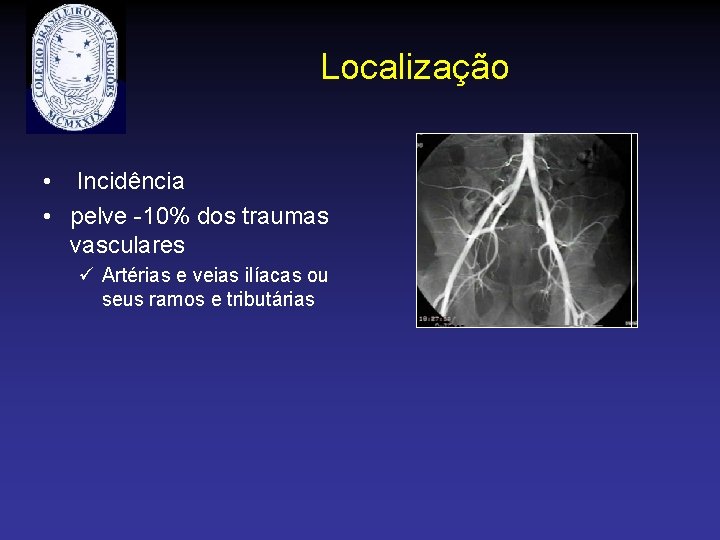 Localização • Incidência • pelve -10% dos traumas vasculares ü Artérias e veias ilíacas