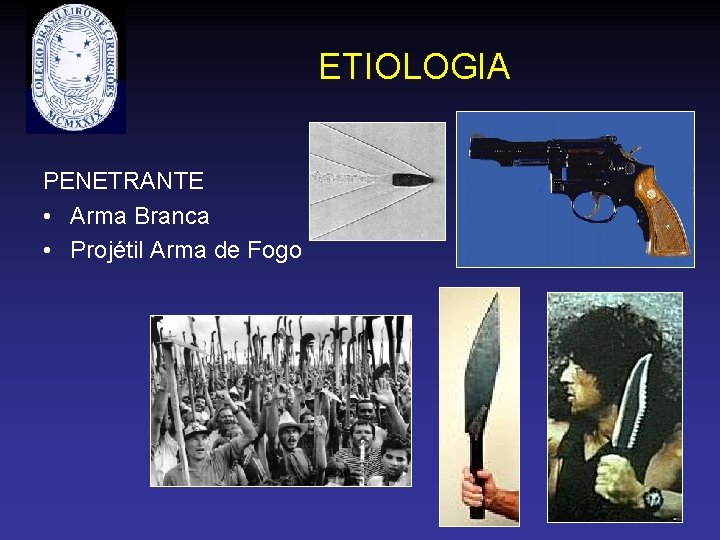 ETIOLOGIA PENETRANTE • Arma Branca • Projétil Arma de Fogo 