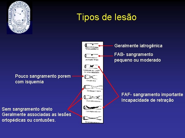 Tipos de lesão Geralmente iatrogênica FAB- sangramento pequeno ou moderado Pouco sangramento porem com